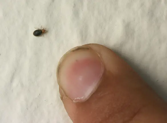 Bed Bugs - Do Bed Bugs Only Bite One Area?