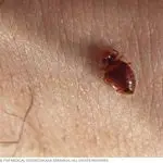 Are Bed Bugs Always in Groups?