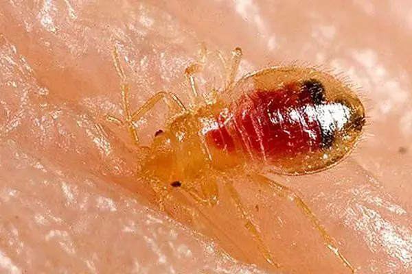 How to Get Rid of Bed Bugs