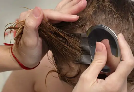 Can Head Lice Give You Headaches?