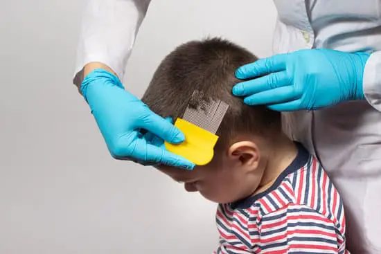 Can You Eat Head Lice?