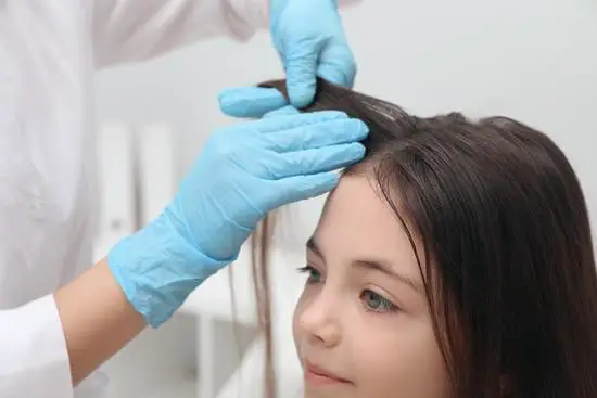 How Long Can You Have Head Lice Without Knowing?