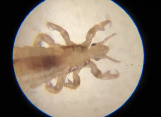 Is Head Lice a Parasite?