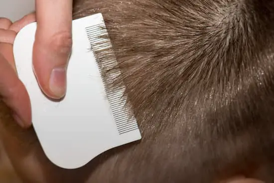 Where Do You Catch Head Lice From?