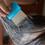 Can You Take a Pill For Head Lice?