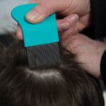 Is it Easy to Catch Head Lice?