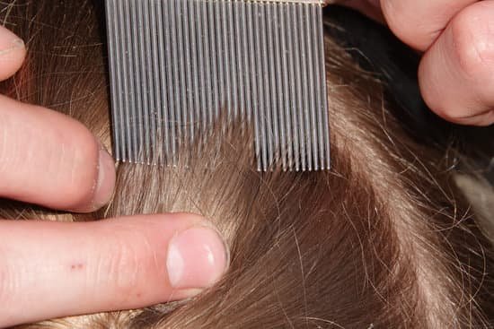 Can Head Lice Cause Sores on the Scalp?