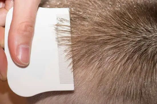 What Head Lice Look Like