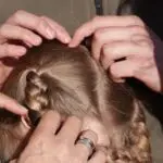 Head Lice - Can Children Get Lice?