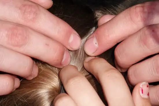 How Can Head Lice Turn Into Body Lice?