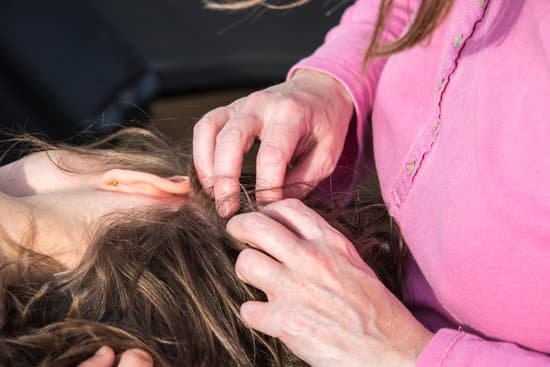 How Can Head Lice Be Seen?