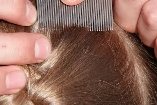 How Long Head Lice Live Off Human Body