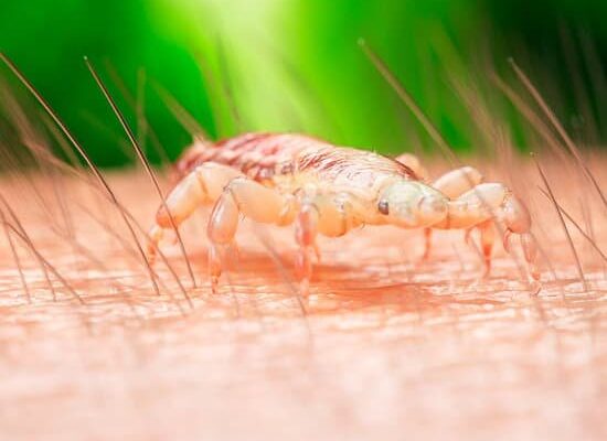 Can Head Lice Move to Pubic Hair?