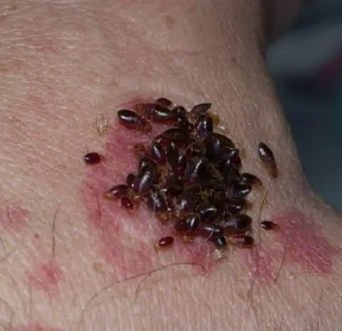 Do Bed Bugs Have Blood in Them?