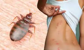 Are There Male and Female Bed Bugs?