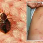 Where to Find Bed Bugs During the Day