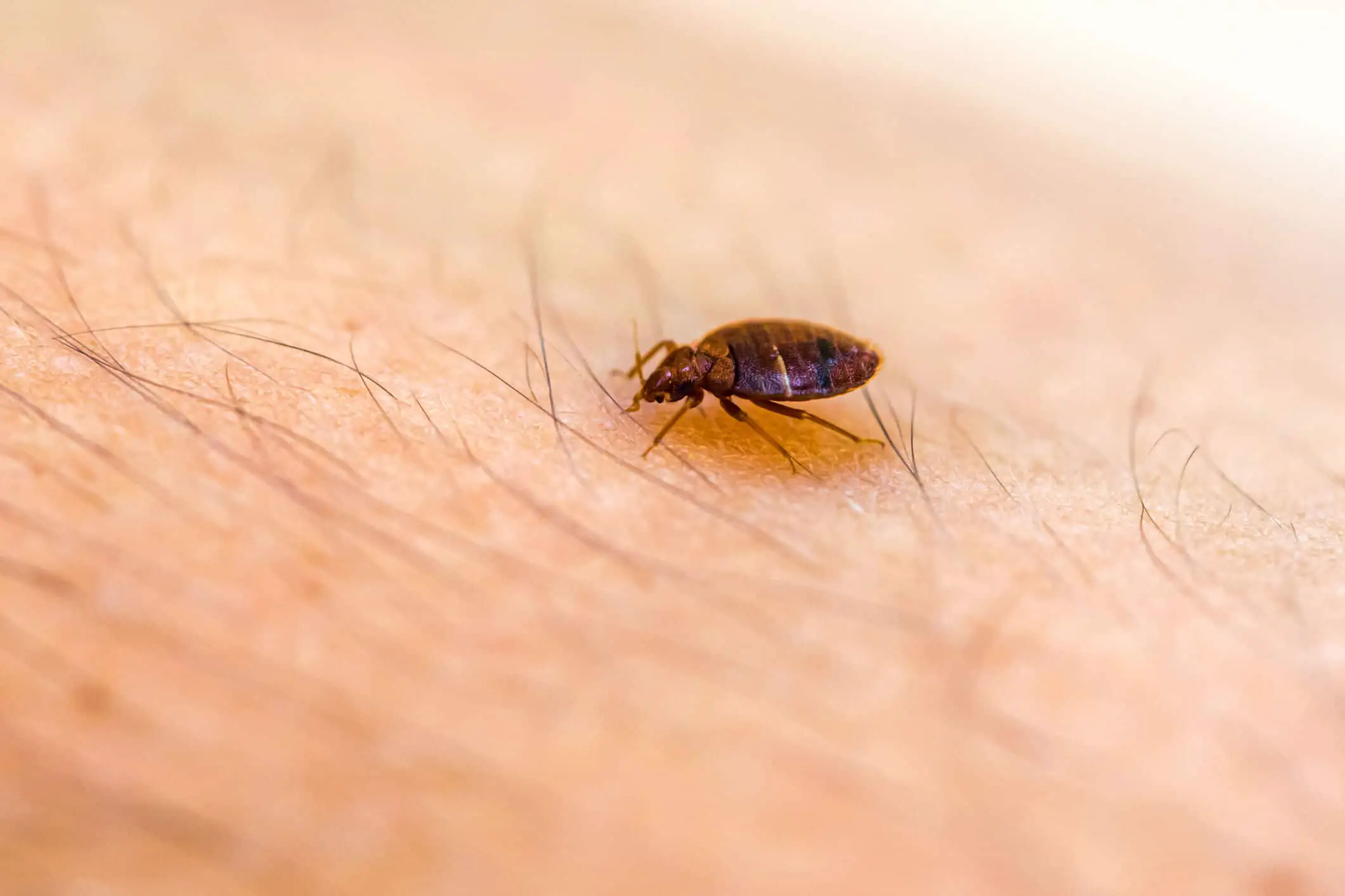 Can You Travel With Bed Bug Bites?
