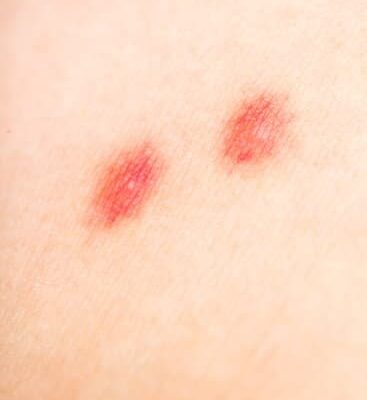 How Do Cat Fleas Look Like?